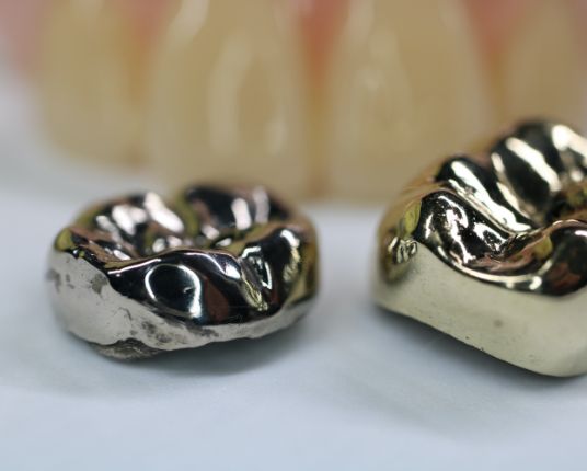 Two stainless steel dental crowns prior to placement
