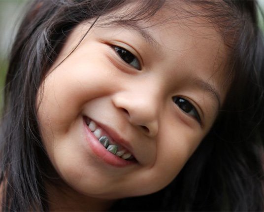 Smiling child with a crown on her front tooth