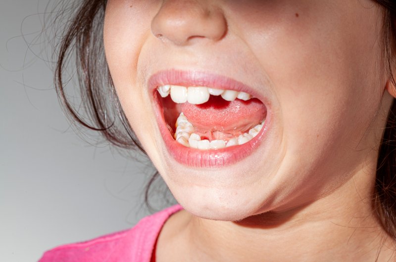 A child needing phase 1 orthodontics